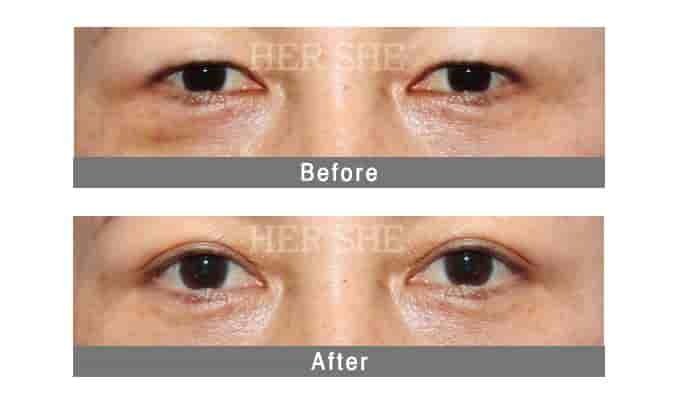 HERSHE Plastic Surgery and Dermatology في Seoul، South Korea تعليقات من مرضى حقيقيين
 Slider image 4