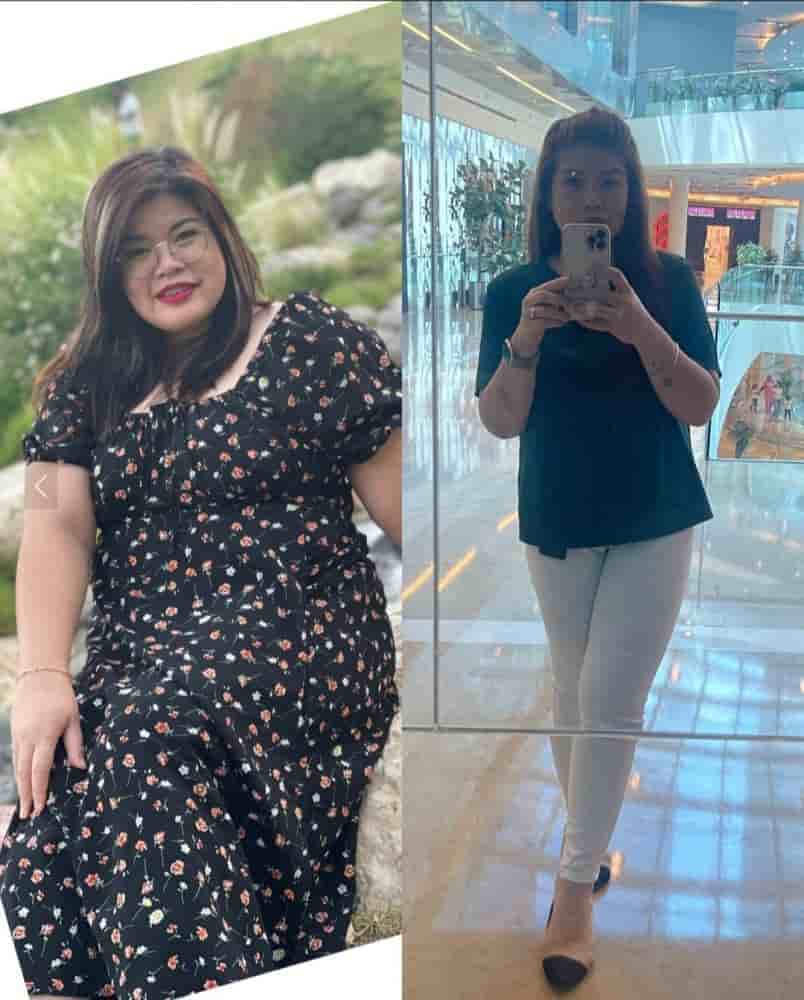 Dr. Islam Abdelkhalek Weight Loss Center في Alexandria، Egypt تعليقات من مرضى حقيقيين
 Slider image 10
