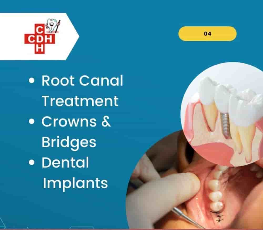 City Dental - Implant Hospital في Rajkot، India تعليقات من مرضى حقيقيين
 Slider image 3