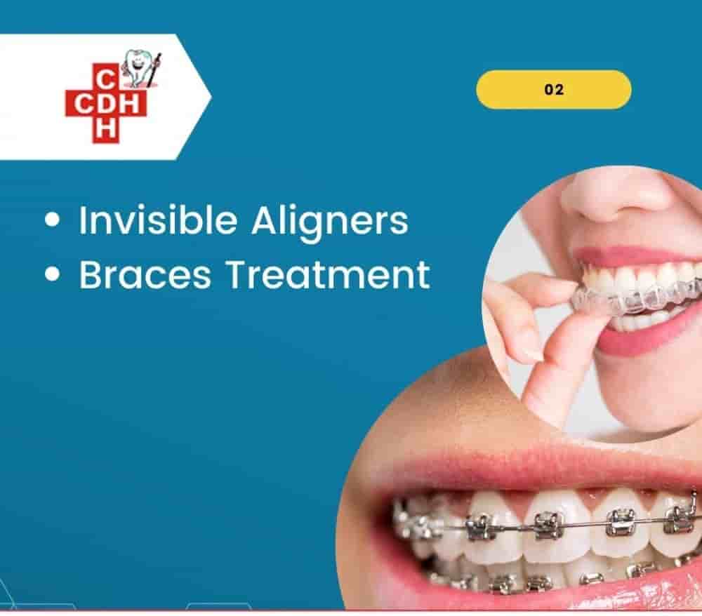 City Dental - Implant Hospital في Rajkot، India تعليقات من مرضى حقيقيين
 Slider image 5