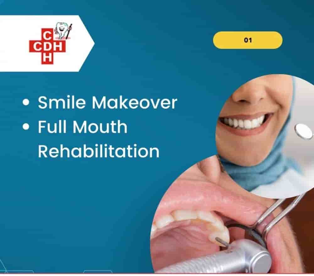 City Dental - Implant Hospital في Rajkot، India تعليقات من مرضى حقيقيين
 Slider image 6
