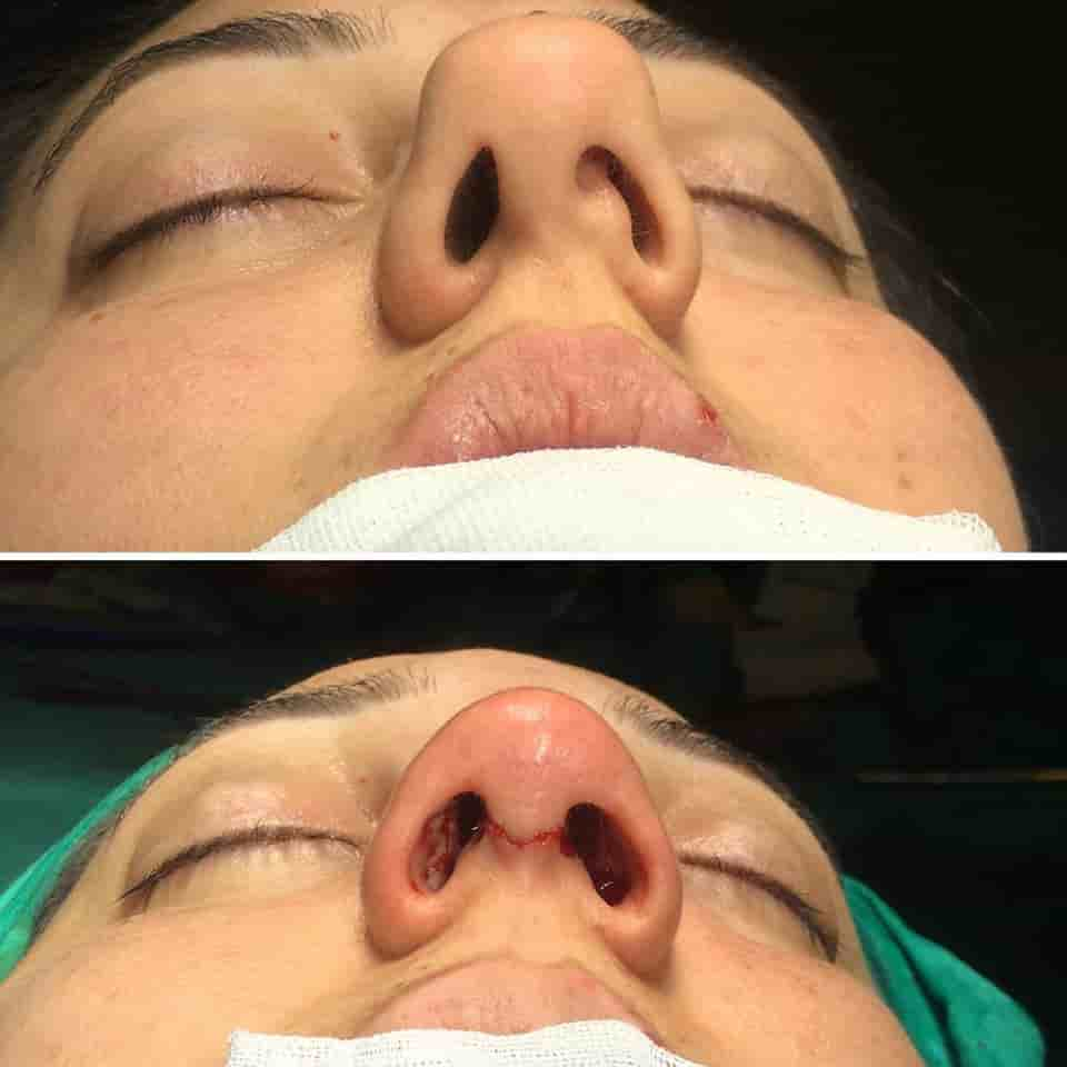 Estetik Center Clinic by Dr. Ali Dursun Kan MD في Istanbul، Turkey تعليقات من مرضى حقيقيين
 Slider image 3