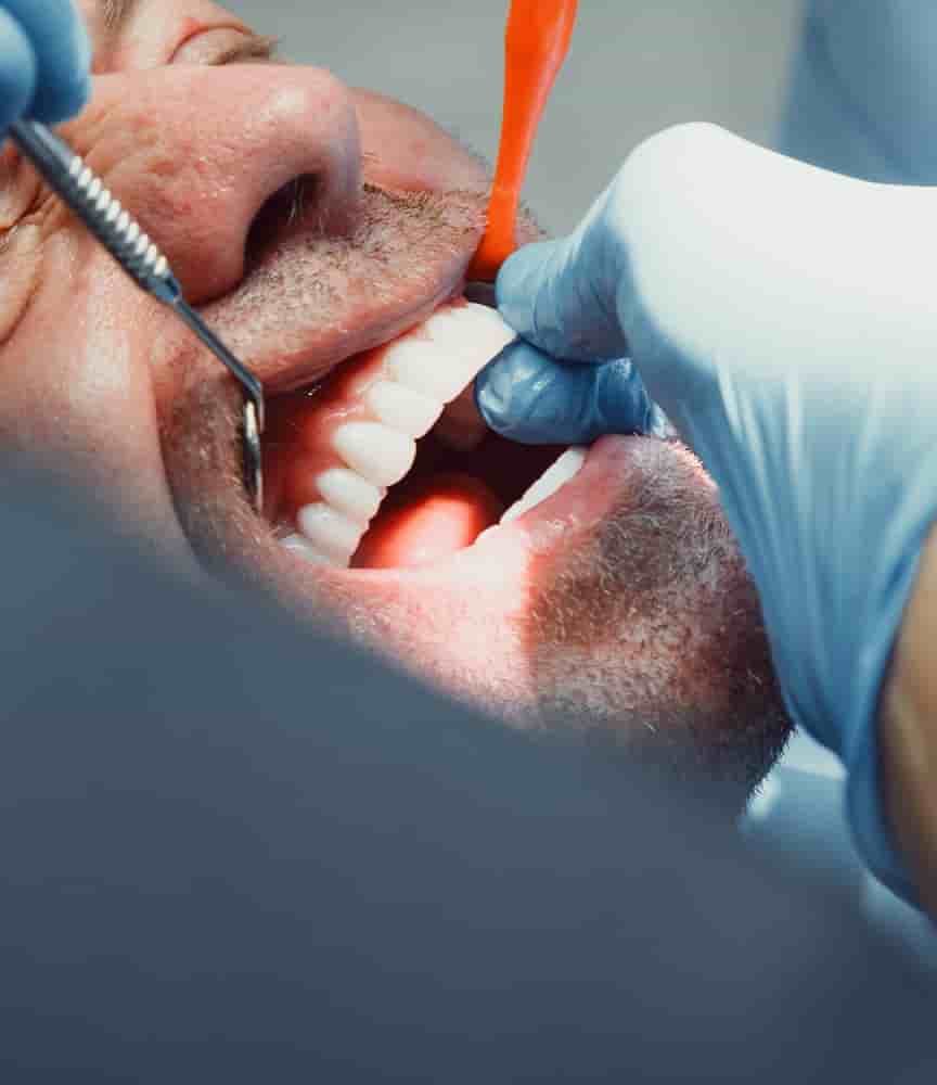 Beyaz Ada Dental Clinic في Antalya، Turkey تعليقات من مرضى حقيقيين
 Slider image 9