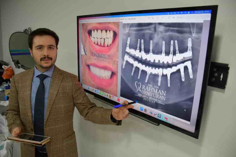 YKN DENTAL CLINIC في Istanbul، Turkey تعليقات من مرضى حقيقيين
 Slider image 5