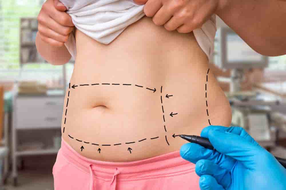 Dr. Asim Uslu - Reconstructive & Aesthetic Surgeon في Antalya، Turkey تعليقات من مرضى حقيقيين
 Slider image 3
