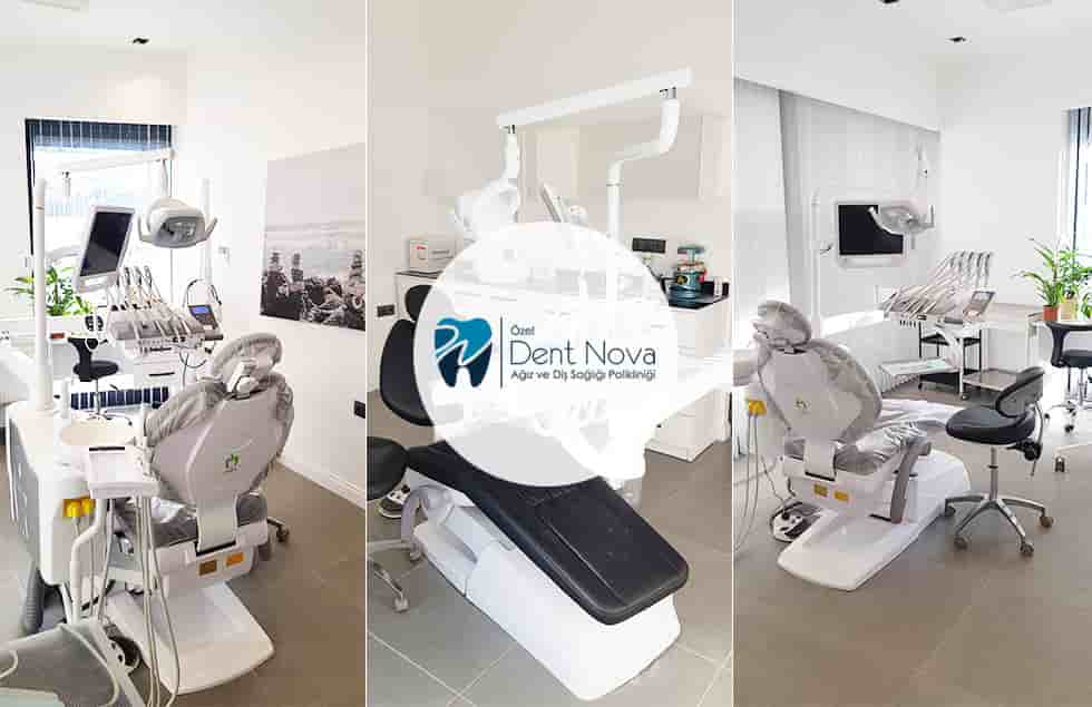 Dent Nova Dental Clinic في Izmir، Turkey تعليقات من مرضى حقيقيين
 Slider image 3