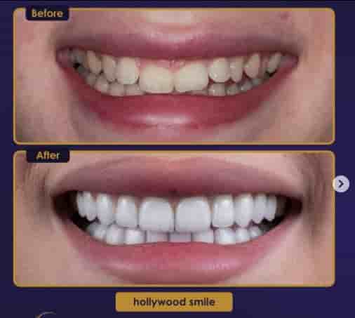 Estherian Clinic في Istanbul، Turkey تعليقات من مرضى حقيقيين
 Slider image 2
