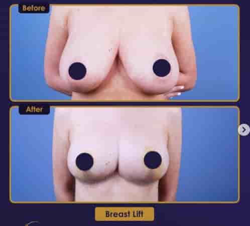 Estherian Clinic في Istanbul، Turkey تعليقات من مرضى حقيقيين
 Slider image 3