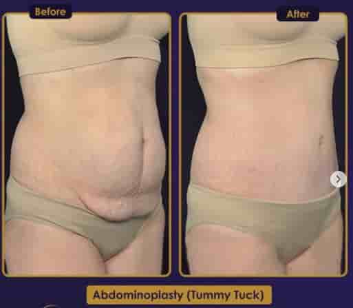Estherian Clinic في Istanbul، Turkey تعليقات من مرضى حقيقيين
 Slider image 5