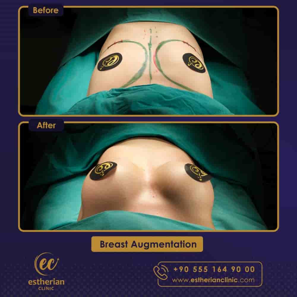 Estherian Clinic في Istanbul، Turkey تعليقات من مرضى حقيقيين
 Slider image 9