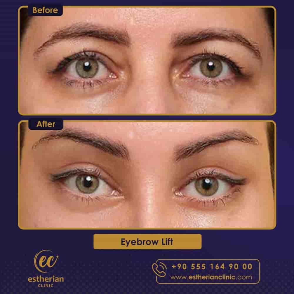 Estherian Clinic في Istanbul، Turkey تعليقات من مرضى حقيقيين
 Slider image 10