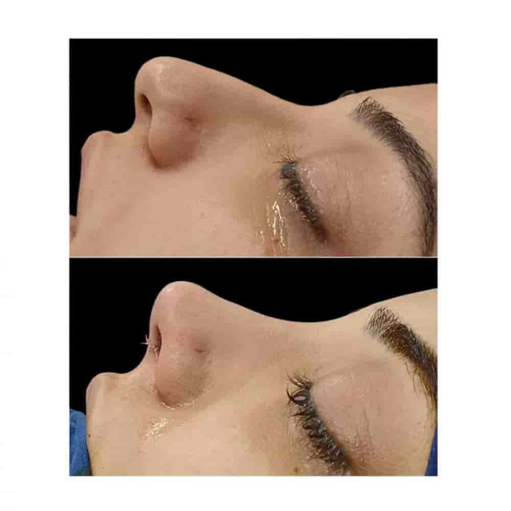 The Nose Aesthetic Clinic في Istanbul، Turkey تعليقات من مرضى حقيقيين
 Slider image 2