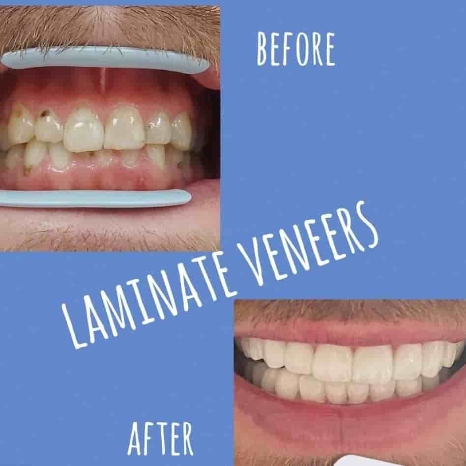 Park Dental Clinic في Aydin، Turkey تعليقات من مرضى حقيقيين
 Slider image 4