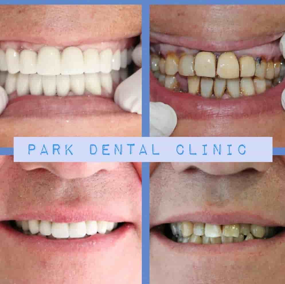 Park Dental Clinic في Aydin، Turkey تعليقات من مرضى حقيقيين
 Slider image 6