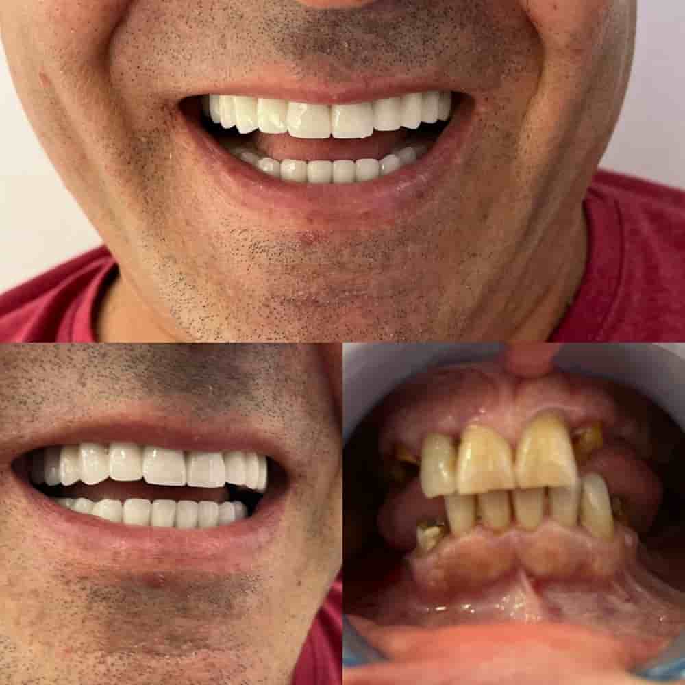 Zirve Dental في Aydin، Turkey تعليقات من مرضى حقيقيين
 Slider image 9
