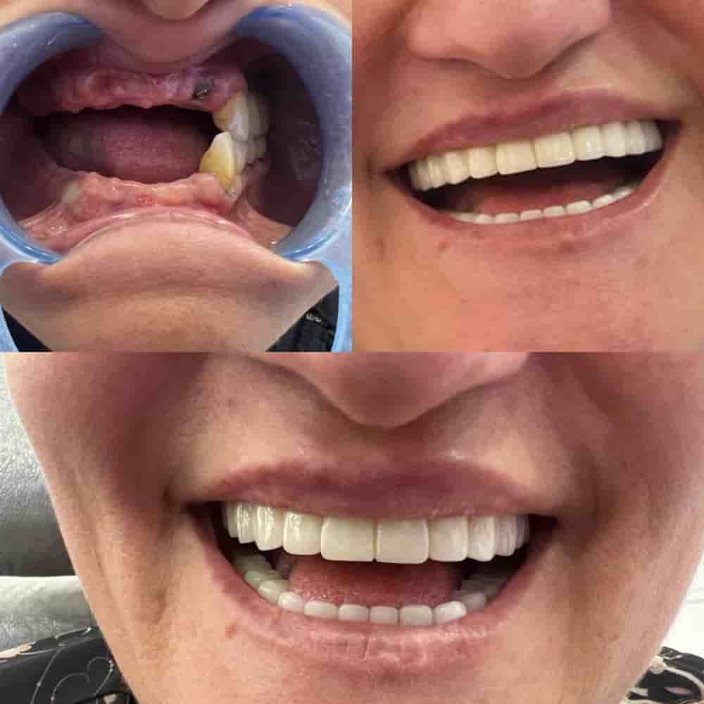 Zirve Dental في Aydin، Turkey تعليقات من مرضى حقيقيين
 Slider image 1
