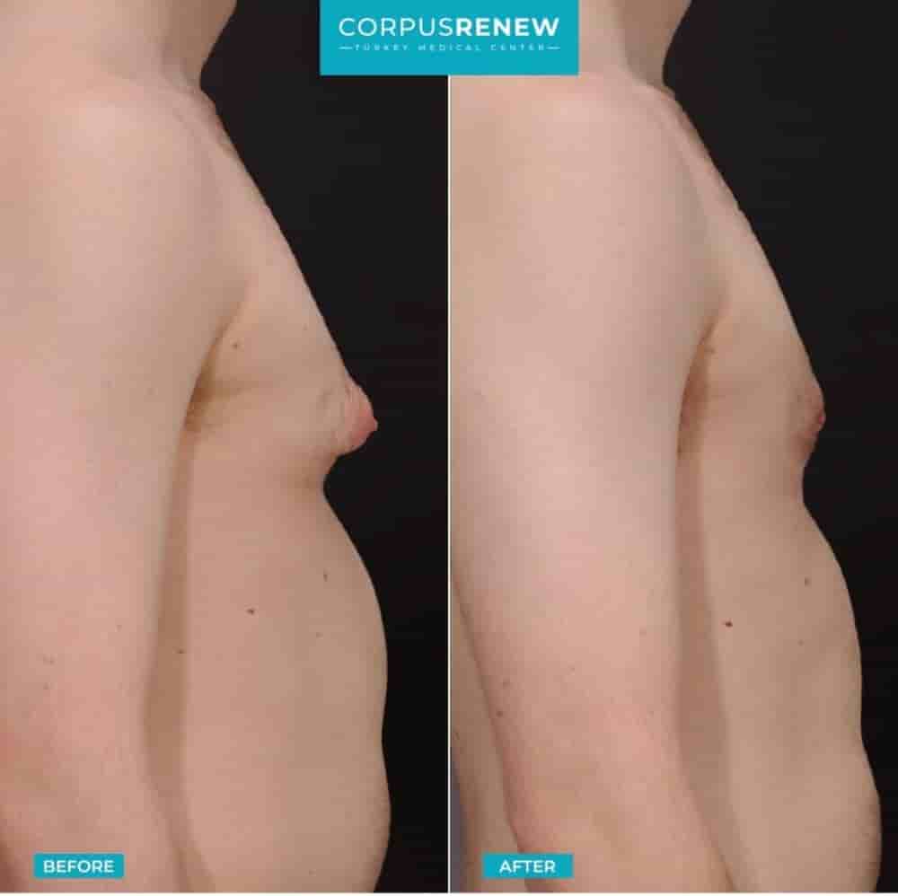 CorpusRenew by Termessos Hospital في Antalya، Turkey تعليقات من مرضى حقيقيين
 Slider image 8