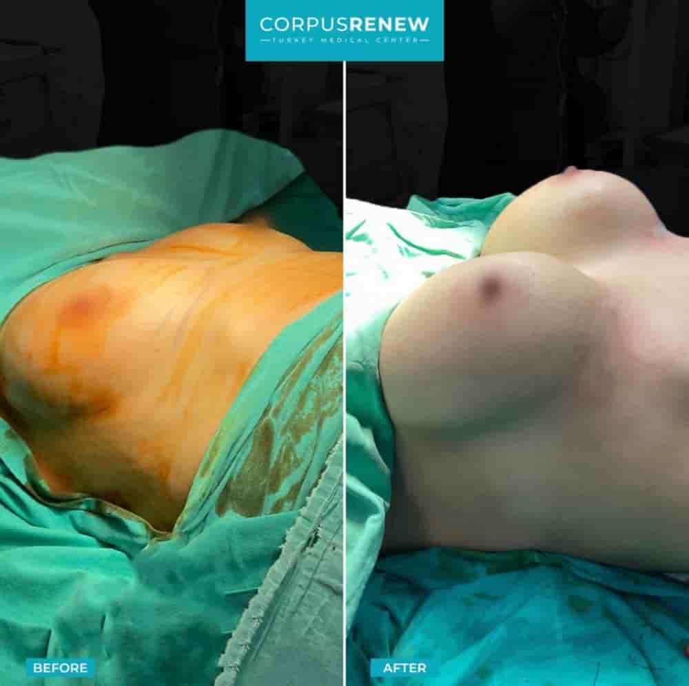 CorpusRenew by Termessos Hospital في Antalya، Turkey تعليقات من مرضى حقيقيين
 Slider image 9