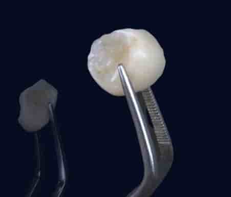 Smile Zone Clinic في Ankara، Turkey تعليقات من مرضى حقيقيين
 Slider image 2