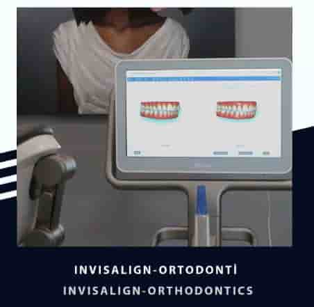 Smile Zone Clinic في Ankara، Turkey تعليقات من مرضى حقيقيين
 Slider image 5