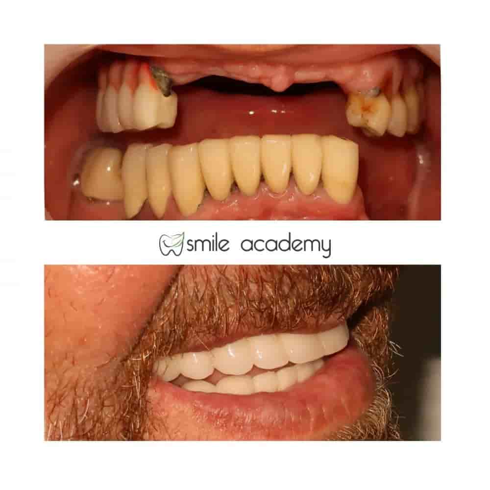 Esthetic Smile Academy  في Istanbul، Turkey تعليقات من مرضى حقيقيين
 Slider image 2