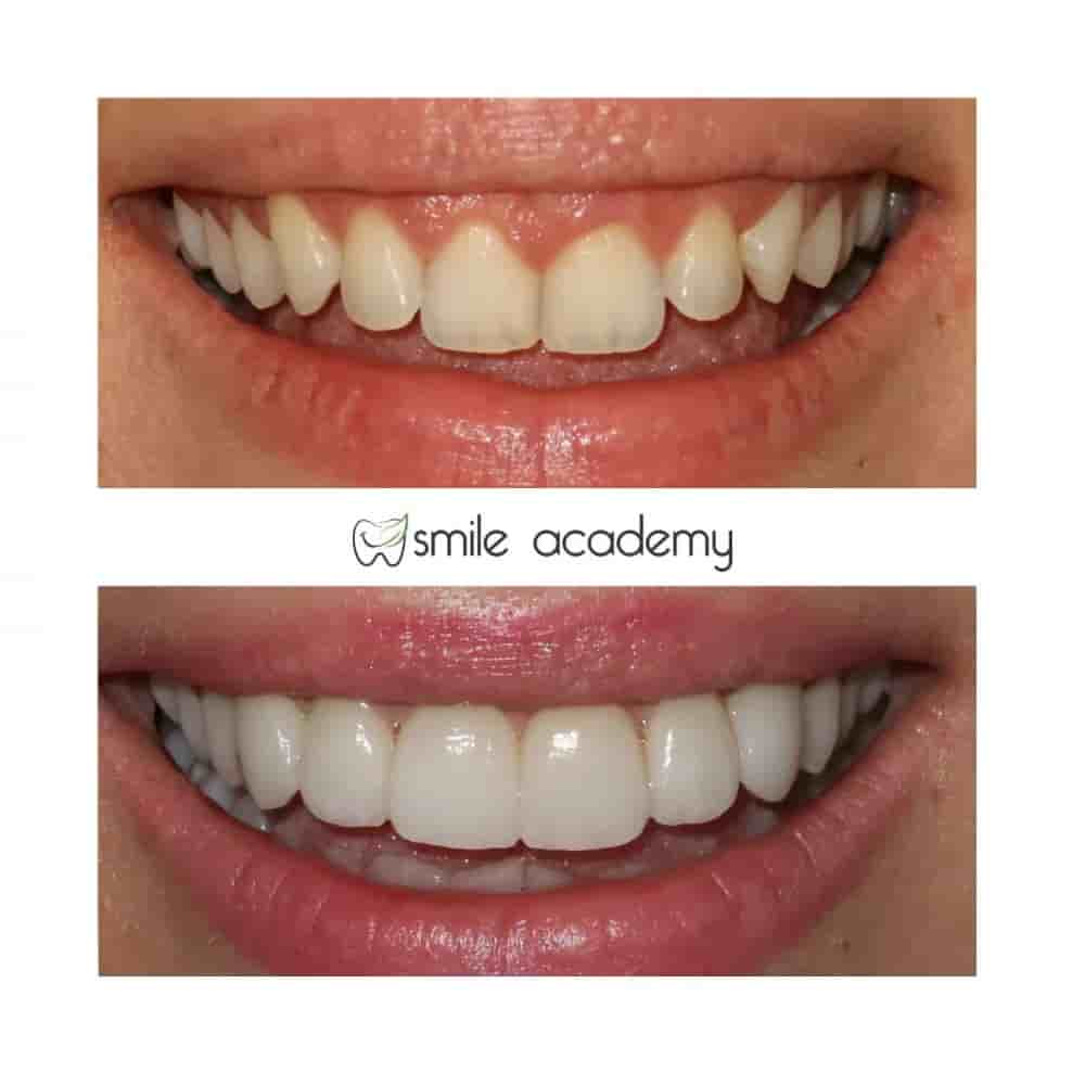 Esthetic Smile Academy  في Istanbul، Turkey تعليقات من مرضى حقيقيين
 Slider image 4