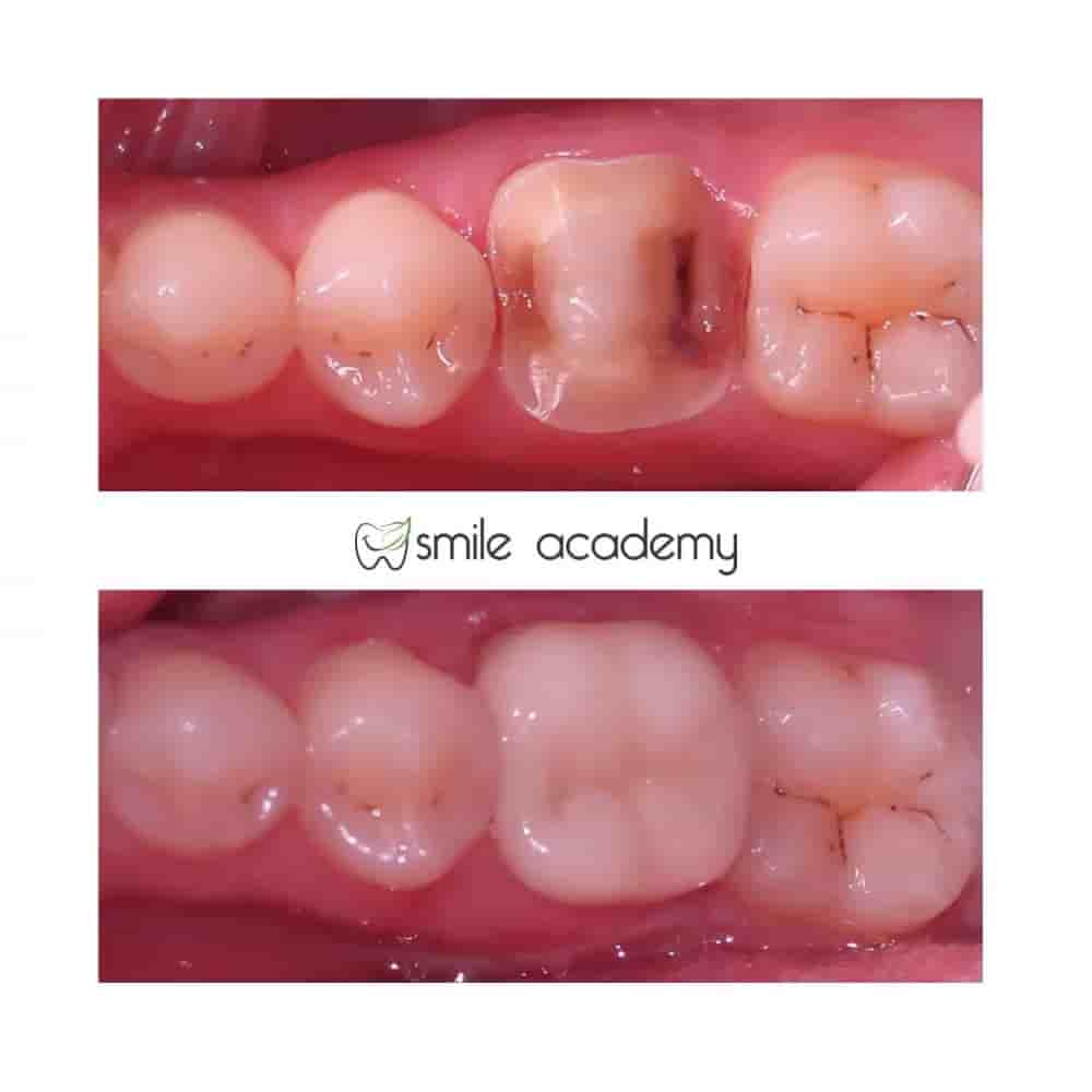 Esthetic Smile Academy  في Istanbul، Turkey تعليقات من مرضى حقيقيين
 Slider image 7