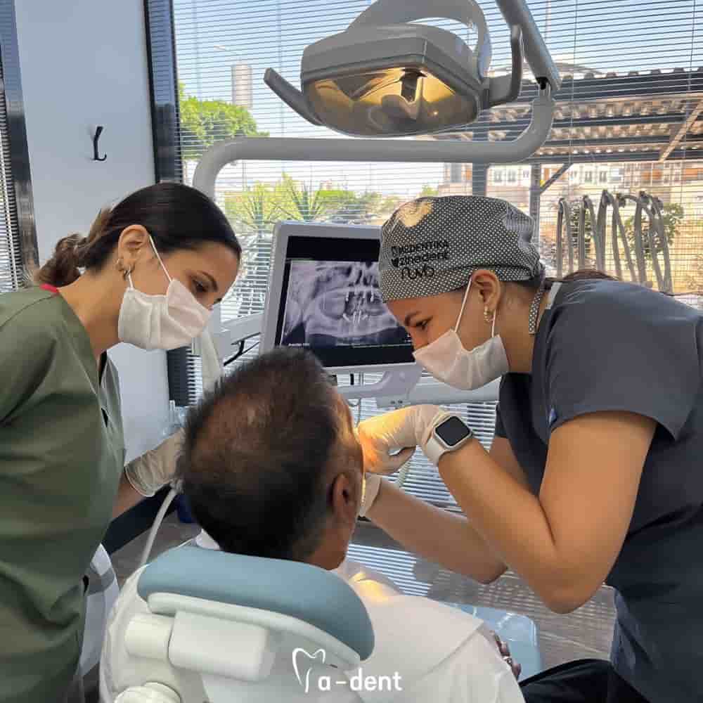 A-dent Dental Clinic في Antalya، Turkey تعليقات من مرضى حقيقيين
 Slider image 3