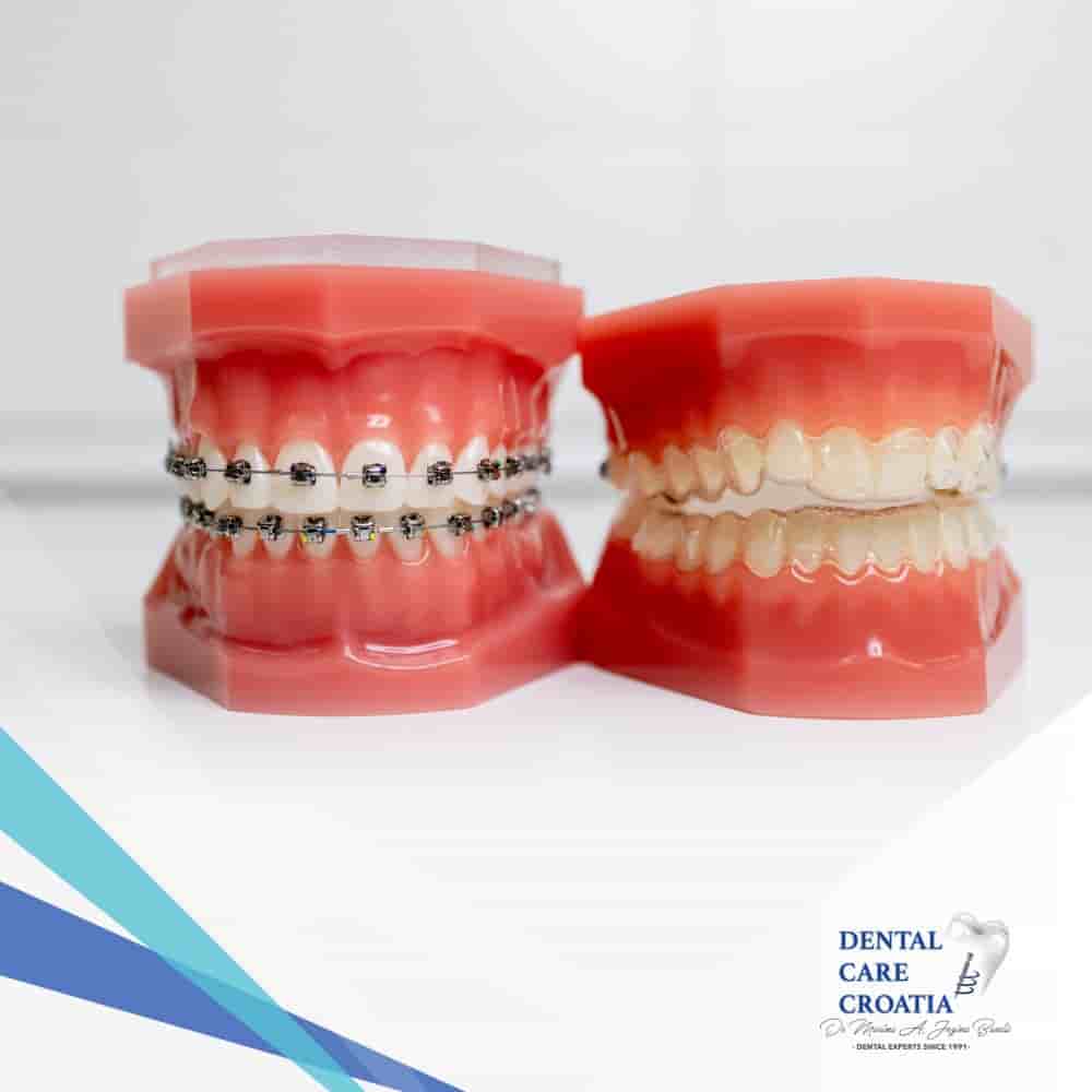 Dental Care Croatia في Split، Croatia تعليقات من مرضى حقيقيين
 Slider image 3