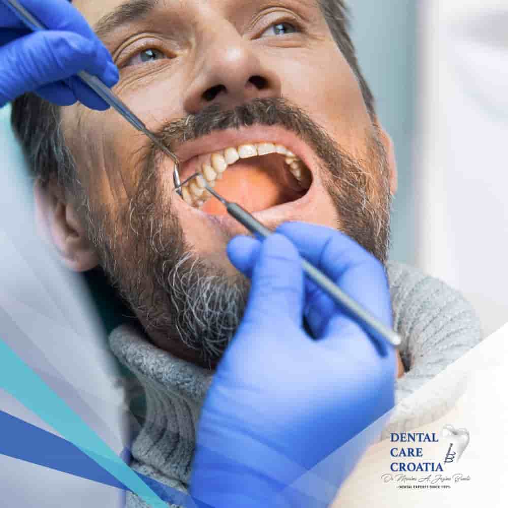 Dental Care Croatia في Split، Croatia تعليقات من مرضى حقيقيين
 Slider image 7