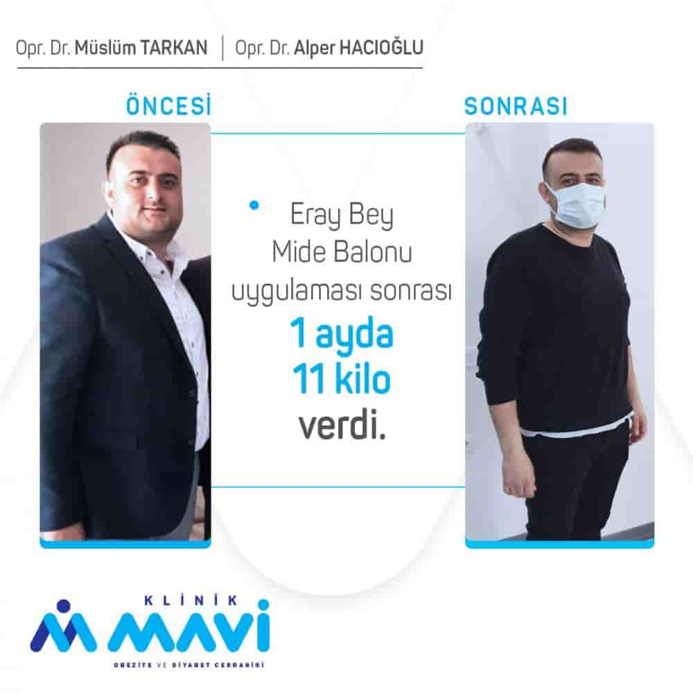 Klinik Mavi في Eskisehir، Turkey تعليقات من مرضى حقيقيين
 Slider image 1