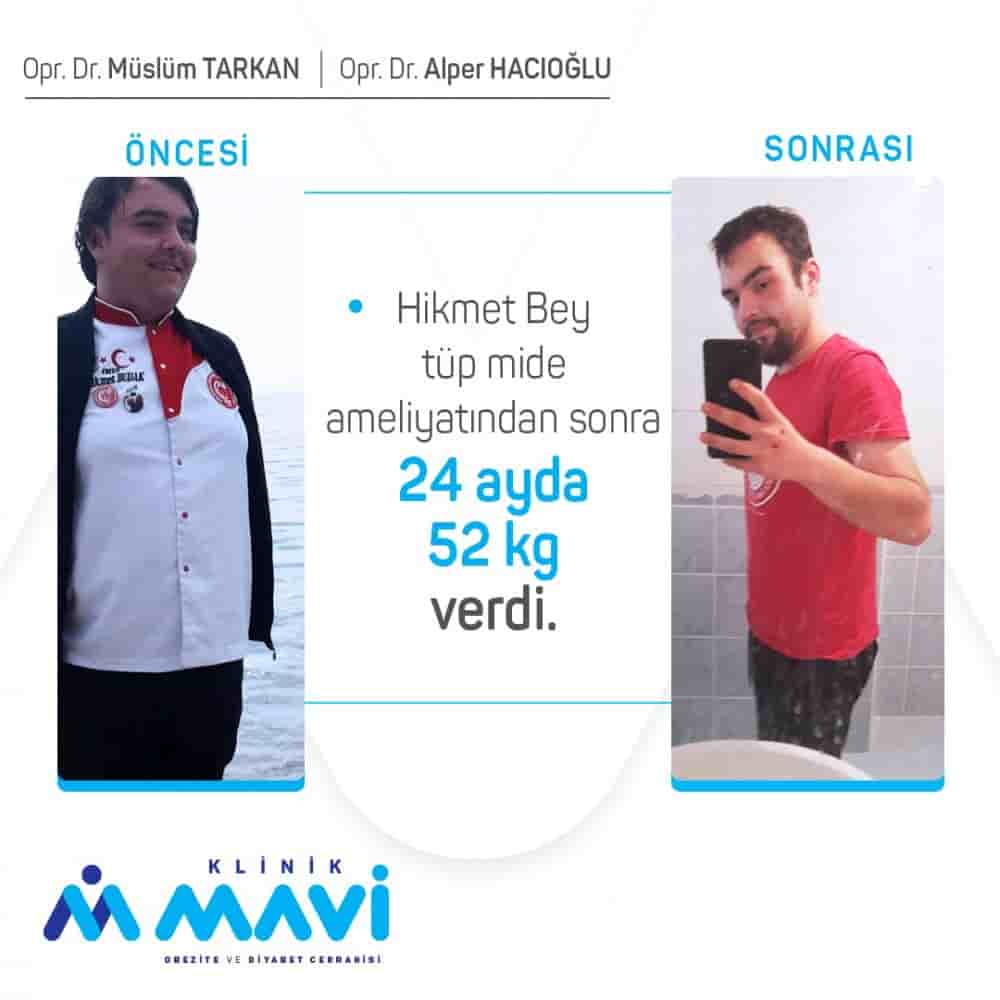 Klinik Mavi في Eskisehir، Turkey تعليقات من مرضى حقيقيين
 Slider image 2