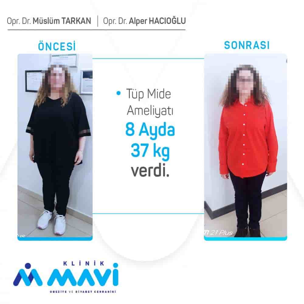 Klinik Mavi في Eskisehir، Turkey تعليقات من مرضى حقيقيين
 Slider image 3