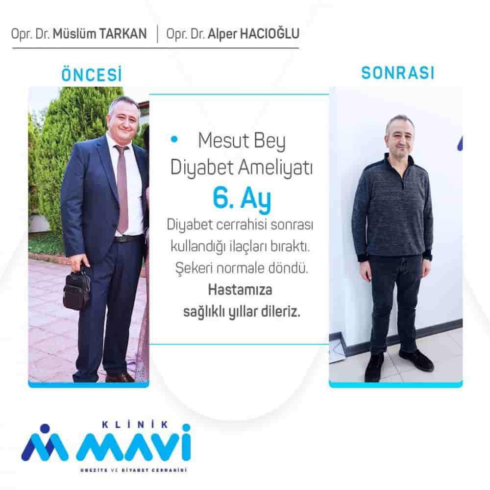 Klinik Mavi في Eskisehir، Turkey تعليقات من مرضى حقيقيين
 Slider image 4
