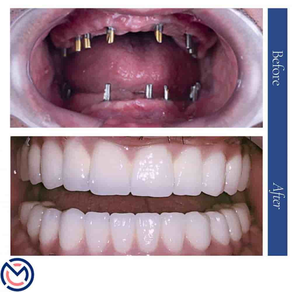 Medicall Me في Istanbul، Turkey تعليقات من مرضى حقيقيين
 Slider image 7