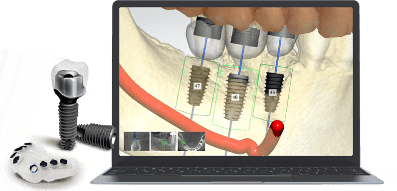 Seoul Today Dental Clinic in Seoul, South Korea Reviews from Real Patients Slider image 5