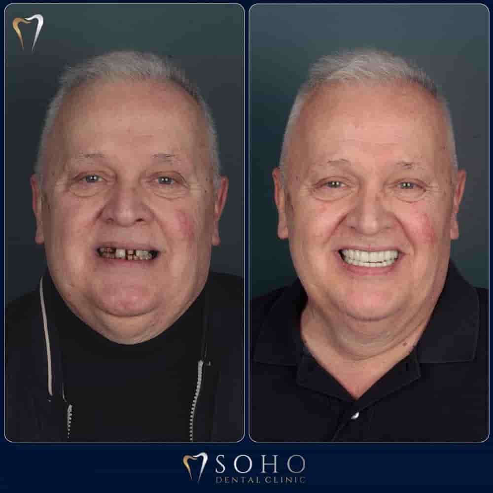 Soho Dental Clinic في Istanbul، Turkey تعليقات من مرضى حقيقيين
 Slider image 1