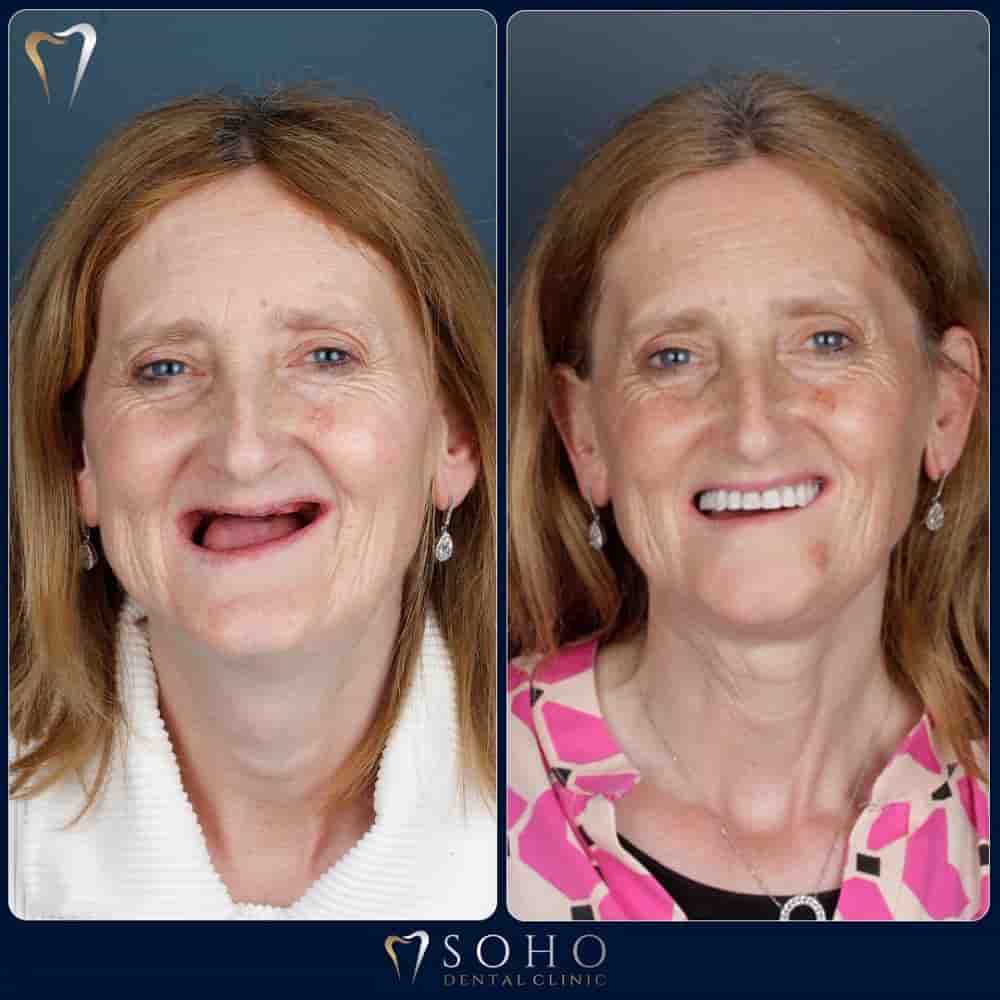 Soho Dental Clinic في Istanbul، Turkey تعليقات من مرضى حقيقيين
 Slider image 4