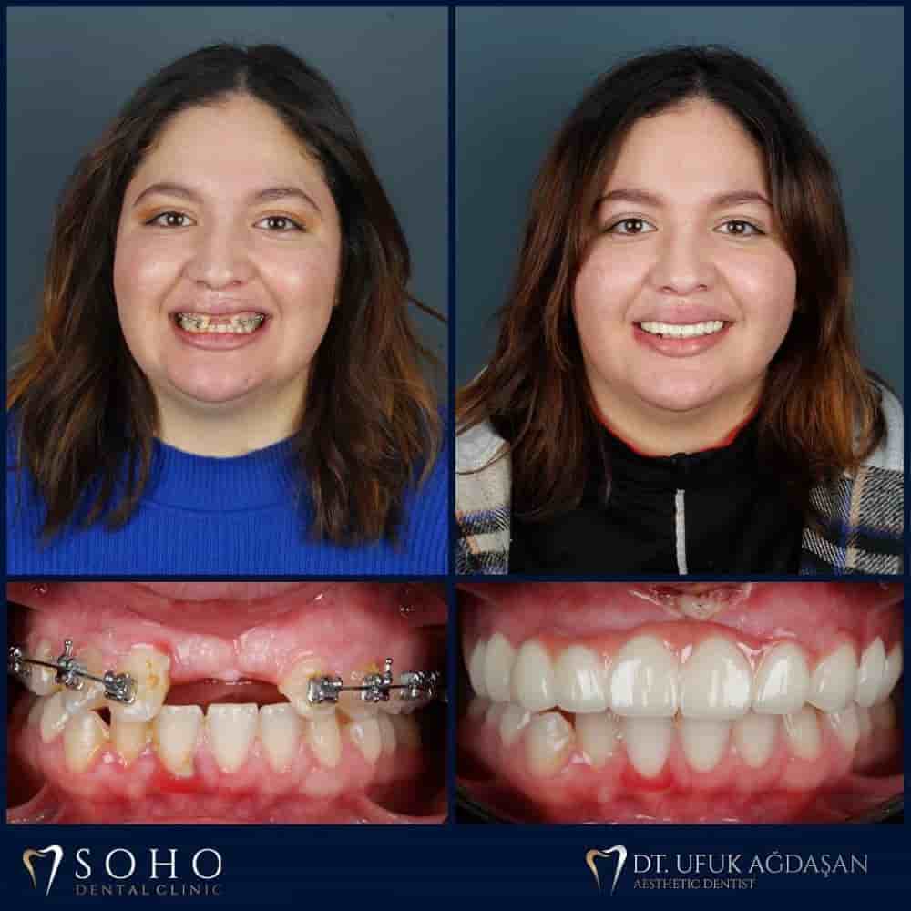 Soho Dental Clinic في Istanbul، Turkey تعليقات من مرضى حقيقيين
 Slider image 7