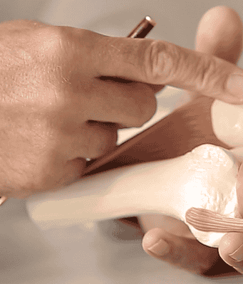 CellReg SVF Cell therapy في Mannheim، Germany تعليقات من مرضى حقيقيين
 Slider image 2