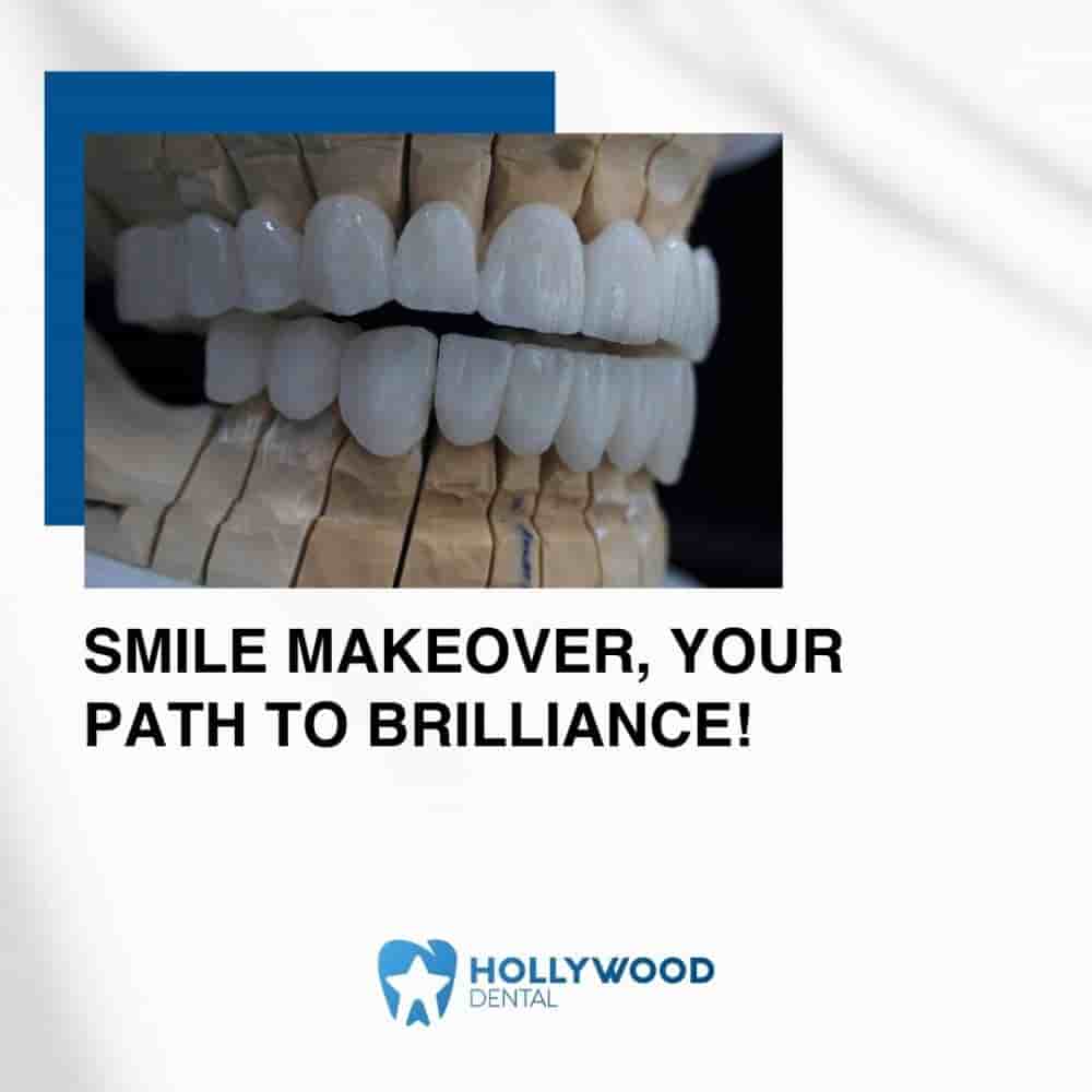 Hollywood Dental Izmir Turkey في Izmir، Turkey تعليقات من مرضى حقيقيين
 Slider image 4