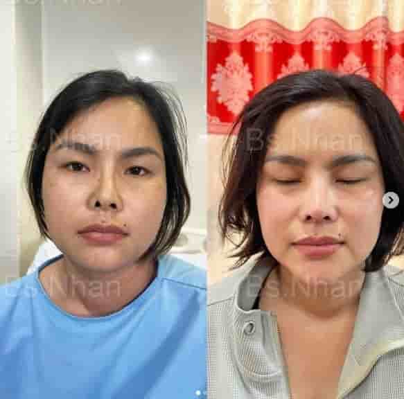 Dr. Nhan Ho Aesthetics and Plastic Surgery في Ho Chi Minh، Vietnam تعليقات من مرضى حقيقيين
 Slider image 1