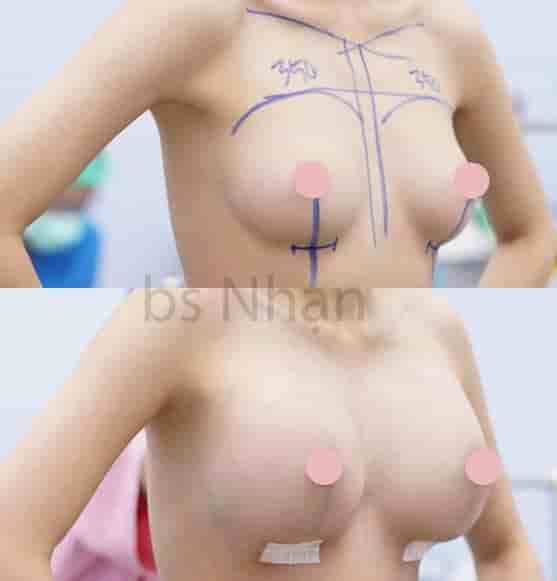 Dr. Nhan Ho Aesthetics and Plastic Surgery في Ho Chi Minh، Vietnam تعليقات من مرضى حقيقيين
 Slider image 2