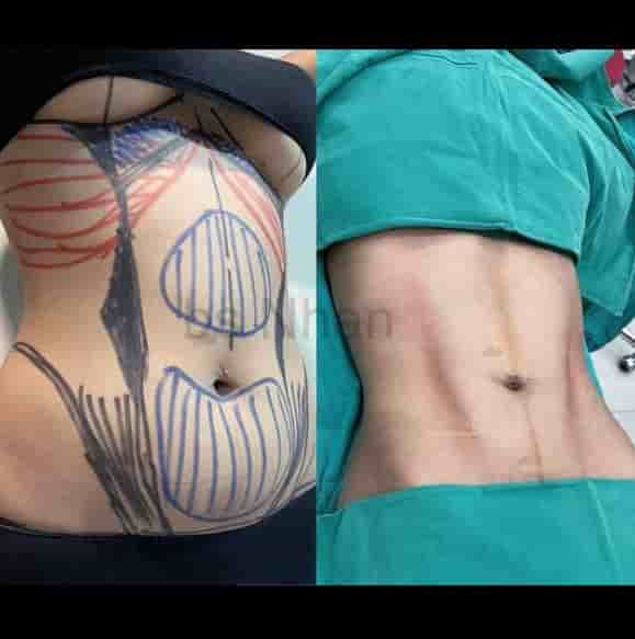 Dr. Nhan Ho Aesthetics and Plastic Surgery في Ho Chi Minh، Vietnam تعليقات من مرضى حقيقيين
 Slider image 3
