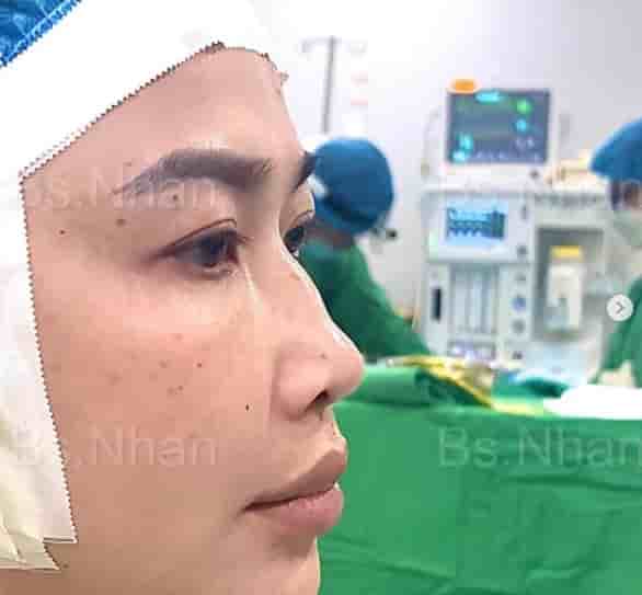 Dr. Nhan Ho Aesthetics and Plastic Surgery في Ho Chi Minh، Vietnam تعليقات من مرضى حقيقيين
 Slider image 6
