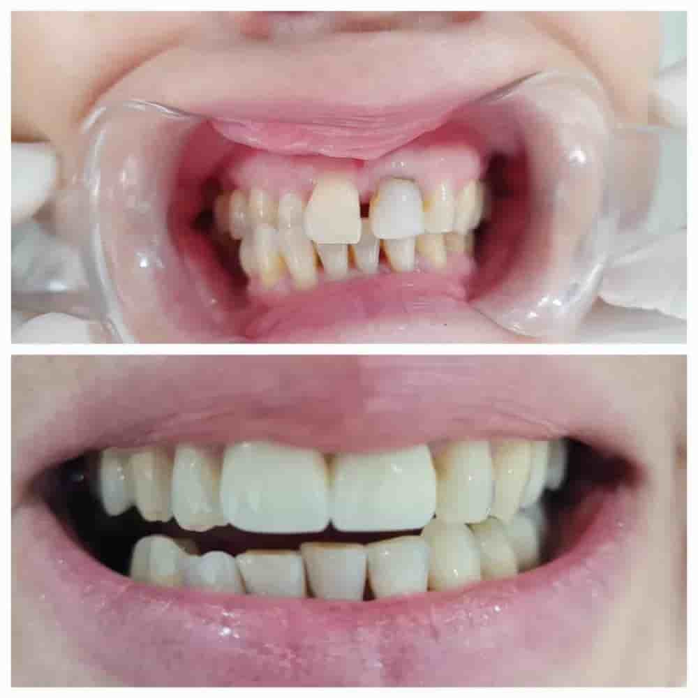 Prestij Dental Clinic في Antalya، Turkey تعليقات من مرضى حقيقيين
 Slider image 6