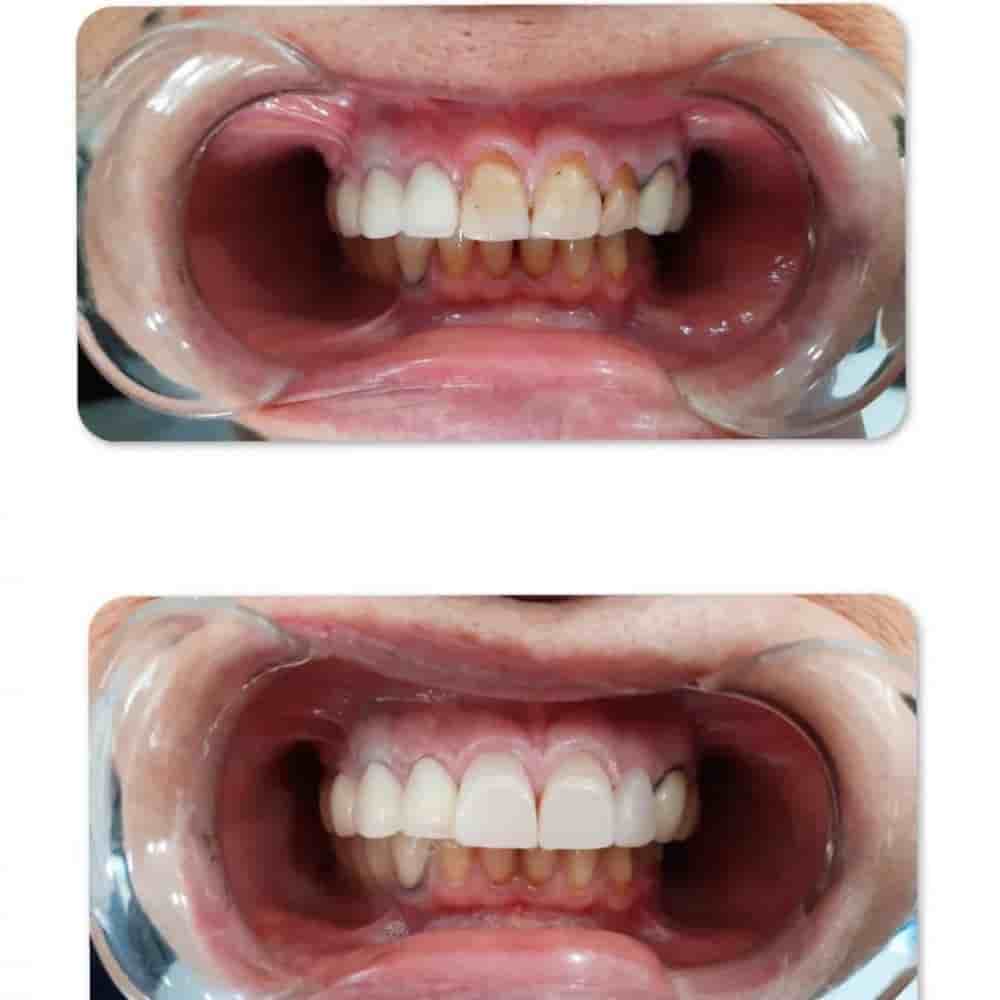 Prestij Dental Clinic في Antalya، Turkey تعليقات من مرضى حقيقيين
 Slider image 7