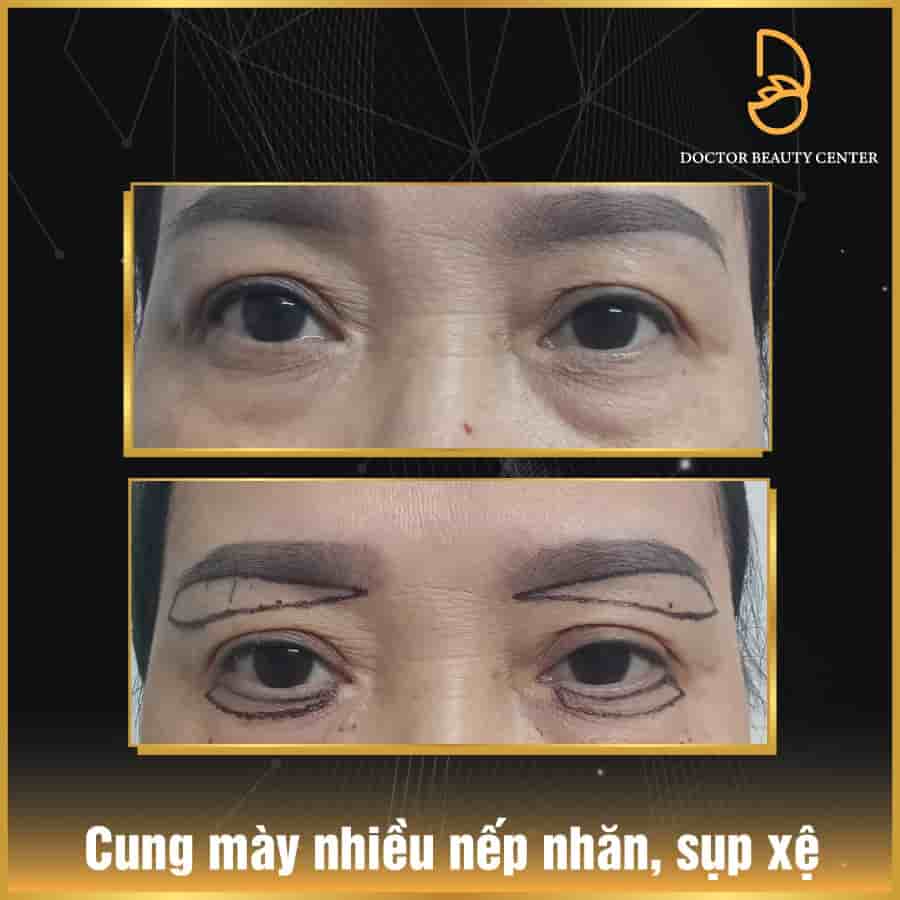 Dr. Harvard - Plastic Surgery في Danang، Vietnam تعليقات من مرضى حقيقيين
 Slider image 8