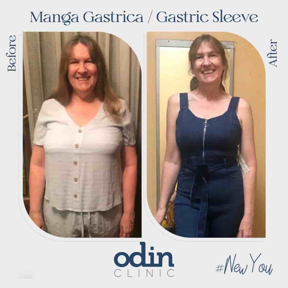 Odin Clinic في Izmir، Turkey تعليقات من مرضى حقيقيين
 Slider image 2