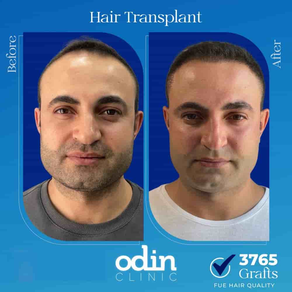 Odin Clinic في Izmir، Turkey تعليقات من مرضى حقيقيين
 Slider image 3